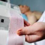 ECG (heart tracing)